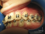 ortodontie zalau